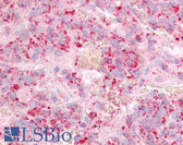Anti-GPR12 Antibody (Extracellular Domain) IHC-plus LS-A308