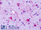 Anti-GPR75 Antibody (Cytoplasmic Domain) IHC-plus LS-A3259