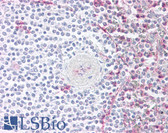 Anti-CCR4 Antibody (N-Terminus) IHC-plus LS-A348