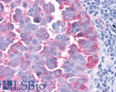 Anti-CCR4 Antibody (C-Terminus) IHC-plus LS-A351
