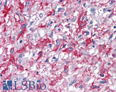 Anti-CNR2 / CB2 Antibody (Internal) IHC-plus LS-A36