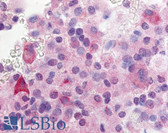 Anti-GPR37L1 Antibody (N-Terminus) IHC-plus LS-A404
