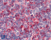 Anti-GPR26 Antibody (Internal) IHC-plus LS-A4143