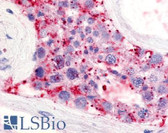 Anti-LPAR5 / GPR92 Antibody (Extracellular Domain) IHC-plus LS-A425