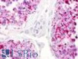 Anti-LPAR5 / GPR92 Antibody (Cytoplasmic Domain) IHC-plus LS-A426