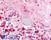 Anti-LPAR5 / GPR92 Antibody (Extracellular Domain) IHC-plus LS-A427