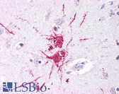 Anti-GPR52 Antibody (C-Terminus) IHC-plus LS-A445