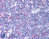 Anti-CCR4 Antibody (Extracellular Domain) IHC-plus LS-A491