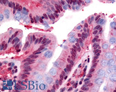 Anti-GPR160 Antibody (Cytoplasmic Domain) IHC-plus LS-A543