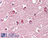 Anti-GPR119 Antibody (Cytoplasmic Domain) IHC-plus LS-A547
