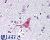 Anti-EDNRB / Endothelin B Receptor Antibody (N-Terminus) IHC-plus LS-A55