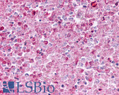 Anti-EDNRB / Endothelin B Receptor Antibody (N-Terminus) IHC-plus LS-A56