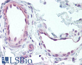Anti-EDNRB / Endothelin B Receptor Antibody (C-Terminus) IHC-plus LS-A57