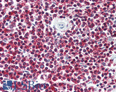 Anti-LGR6 Antibody (Internal) IHC-plus LS-A621