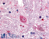 Anti-GPR88 Antibody (Cytoplasmic Domain) IHC-plus LS-A6318
