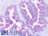 Anti-GPR63 Antibody (Extracellular Domain) IHC-plus LS-A6357