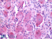 Anti-MRGPRX2 / MRGX2 Antibody (Extracellular Domain) IHC-plus LS-A6645