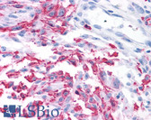 Anti-GRM2 / MGLUR2 Antibody (N-Terminus) IHC-plus LS-A6733