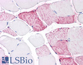 Anti-PTPRA / RPTP-Alpha Antibody (Extracellular Domain) IHC-plus LS-A6795