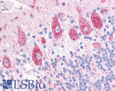 Anti-DUSP23 Antibody (Internal) IHC-plus LS-A6806