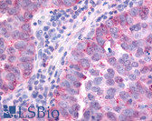 Anti-PAK6 Antibody (Linker Domain) IHC-plus LS-A6942