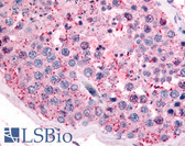 Anti-PAK6 Antibody (N-Terminus) IHC-plus LS-A6949