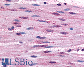 Anti-ADRA1B Antibody (Cytoplasmic Domain) IHC-plus LS-A696