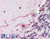 Anti-NEK7 Antibody (N-Terminus) IHC-plus LS-A7163