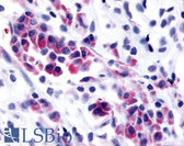 Anti-NEK9 Antibody (Kinase Domain) IHC-plus LS-A7175