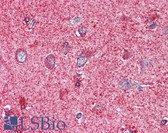 Anti-PAK7 Antibody (Internal) IHC-plus LS-A7308