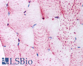 Anti-TNIK Antibody (Internal) IHC-plus LS-A7393