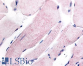 Anti-WNK1 Antibody (Internal) IHC-plus LS-A7484