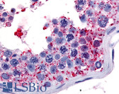 Anti-WNK1 Antibody (Internal) IHC-plus LS-A7494