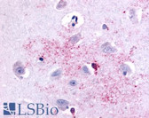 Anti-PAK6 Antibody (Linker Domain) IHC-plus LS-A7962