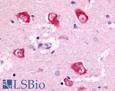 Anti-PAK7 Antibody (Internal) IHC-plus LS-A7963