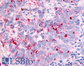 Anti-CDC7 Antibody (Kinase Domain) IHC-plus LS-A7980