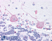 Anti-MCHR2 Antibody (C-Terminus) IHC-plus LS-A1848