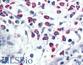 Anti-CXCR1 Antibody (Internal) IHC-plus LS-A807