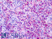 Anti-CXCR1 Antibody (C-Terminus) IHC-plus LS-A808