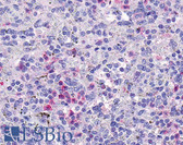 Anti-HCAR3 / GPR109B / HM74 Antibody (C-Terminus) IHC-plus LS-A183