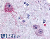 Anti-PACE4 / PCSK6 Antibody (Internal) IHC-plus LS-A8407