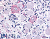 Anti-VRL1 / TRPV2 Antibody (Internal) IHC-plus LS-A8738
