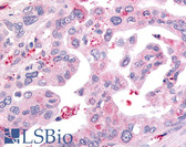 Anti-USP4 Antibody (Internal) IHC-plus LS-A8564