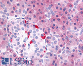 Anti-PDE7B Antibody (Internal) IHC-plus LS-A705