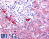 Anti-PDE7B Antibody (C-Terminus) IHC-plus LS-A706