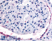 Anti-EPHA4 / EPH Receptor A4 Antibody (Internal) IHC-plus LS-A2839