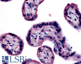 Anti-SLC7A5 / CD98 Light Chain Antibody (Internal) IHC-plus LS-A3097