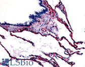 Anti-CAV1 / Caveolin 1 Antibody (N-Terminus) IHC-plus LS-A2869