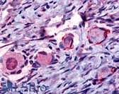 Anti-NR4A1 / NUR77 Antibody (Internal) IHC-plus LS-A2830