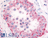 Anti-PDE11A Antibody (Internal) IHC-plus LS-A746